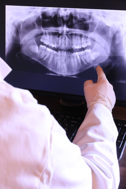 Best Emergency Dental Care for Broken or Chipped Teeth in North Plymouth, MA